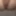 Nutsack + Balls stuffed in ass