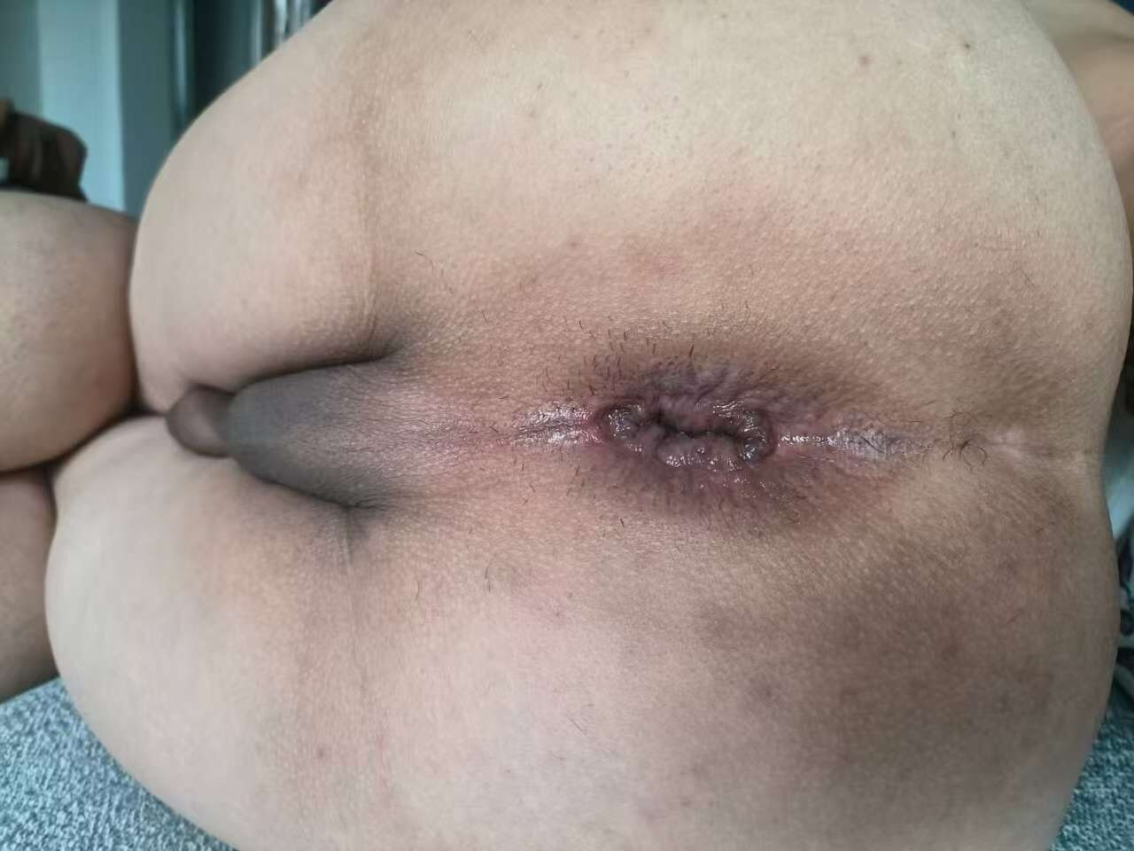 หีมือสองของกู