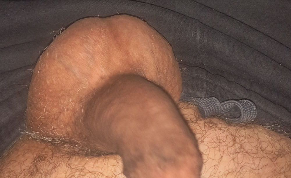 Un Groomed Un Bound Ball Sack  #2