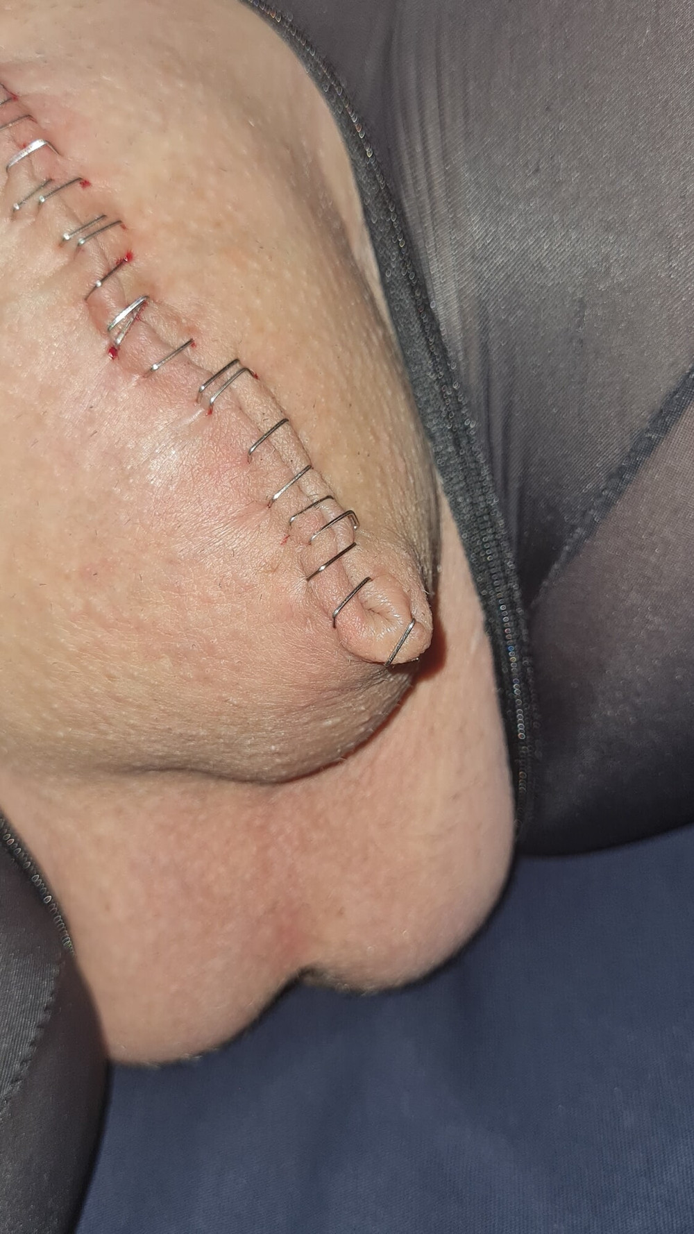 Stapled cock and balls #12