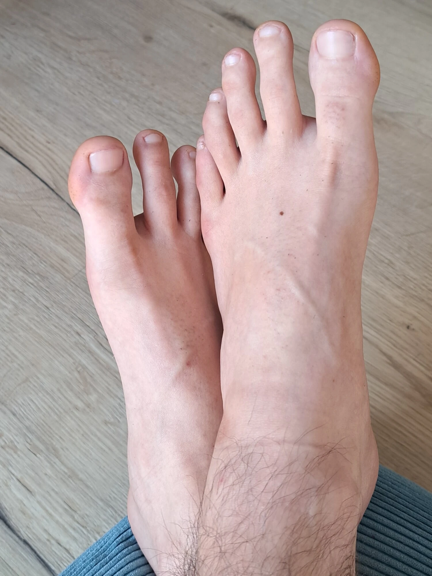 Feet and Soles
