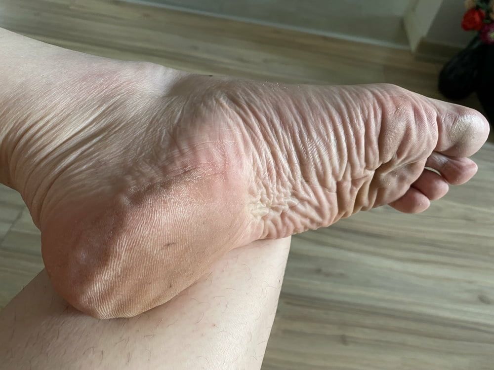 Just my wrinkled soles #5