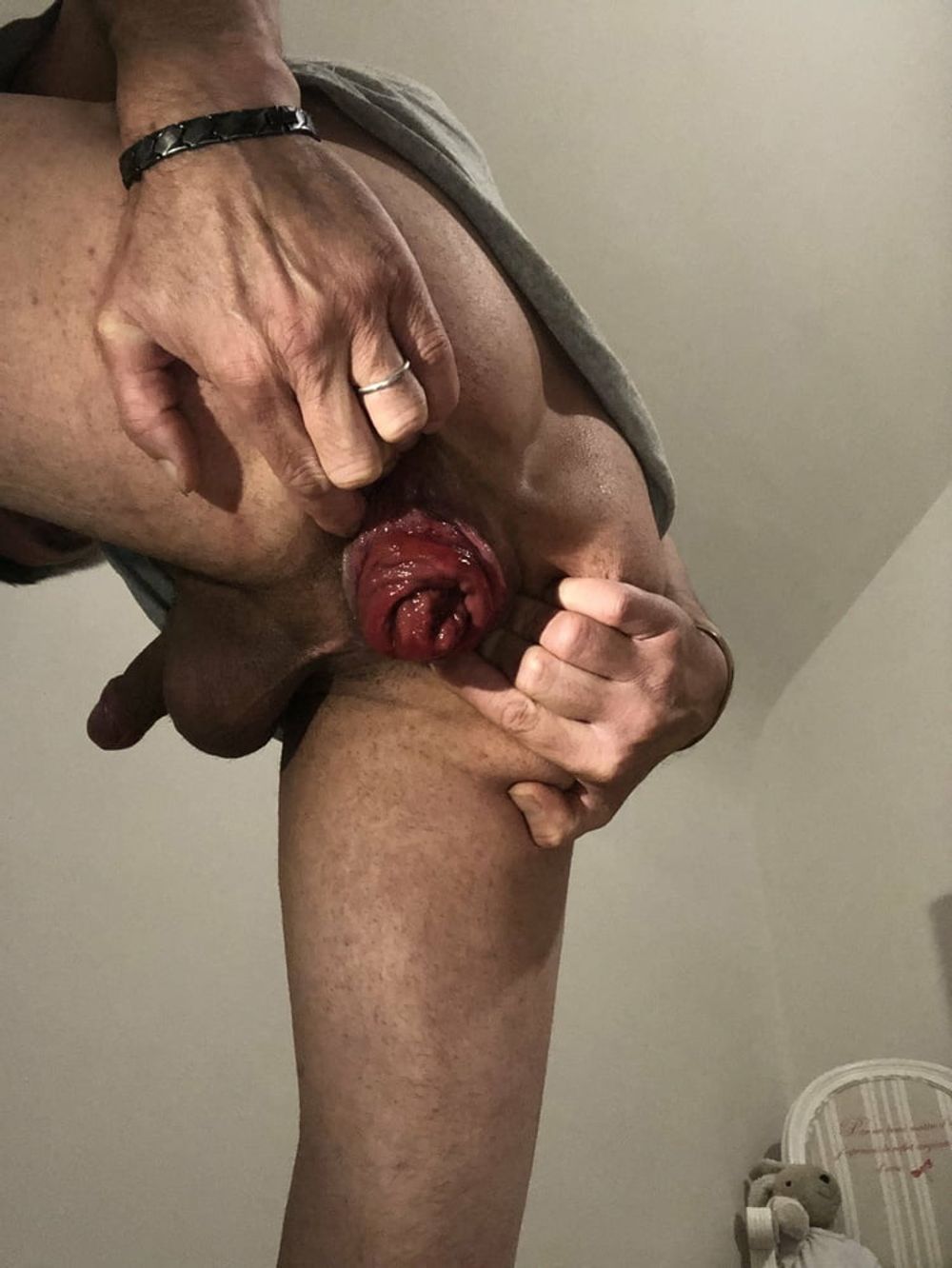 wow magic this anal prolapse ... #6