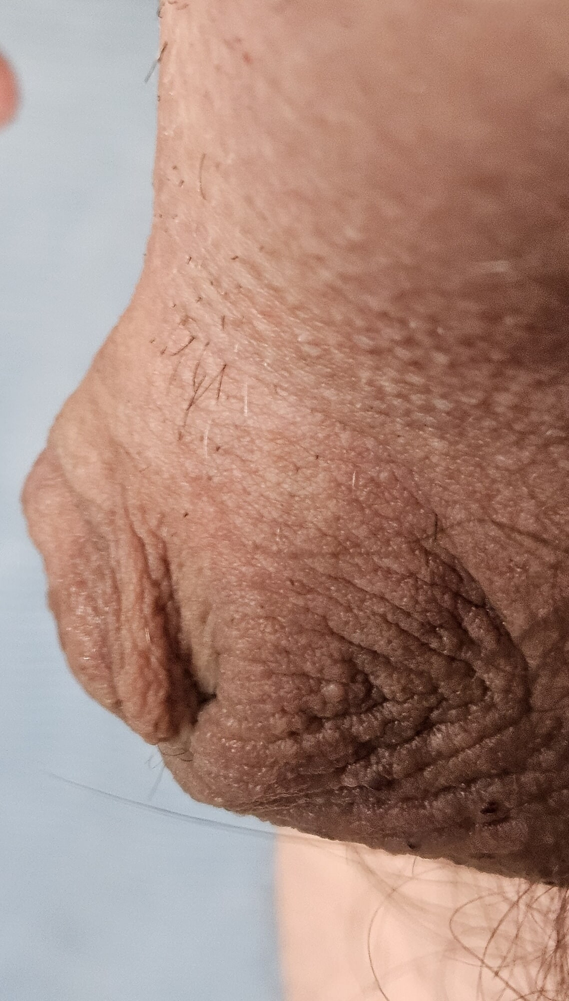 Micro Penis