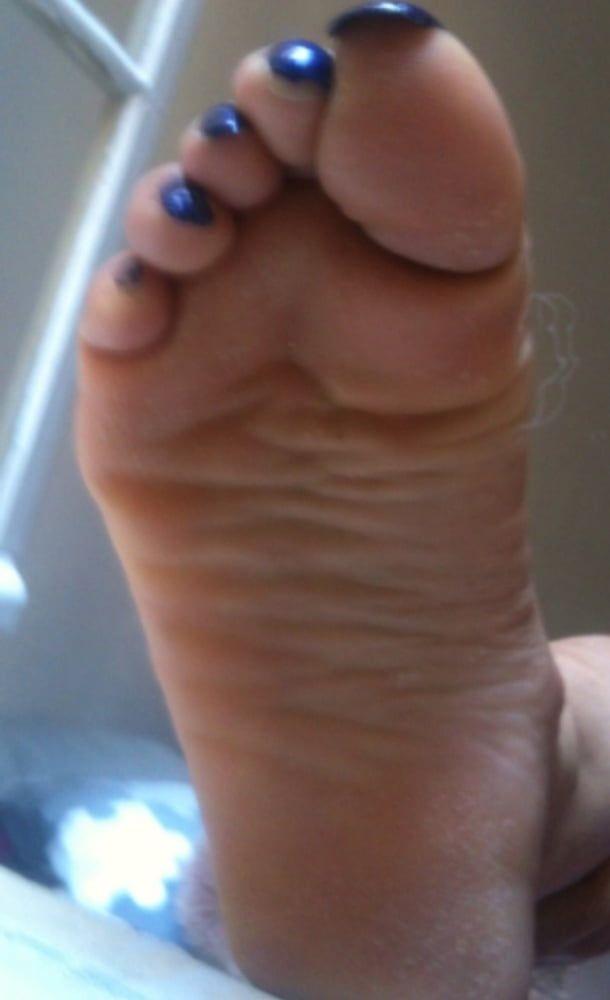 blue toenails and soles feet after day at beach  #22