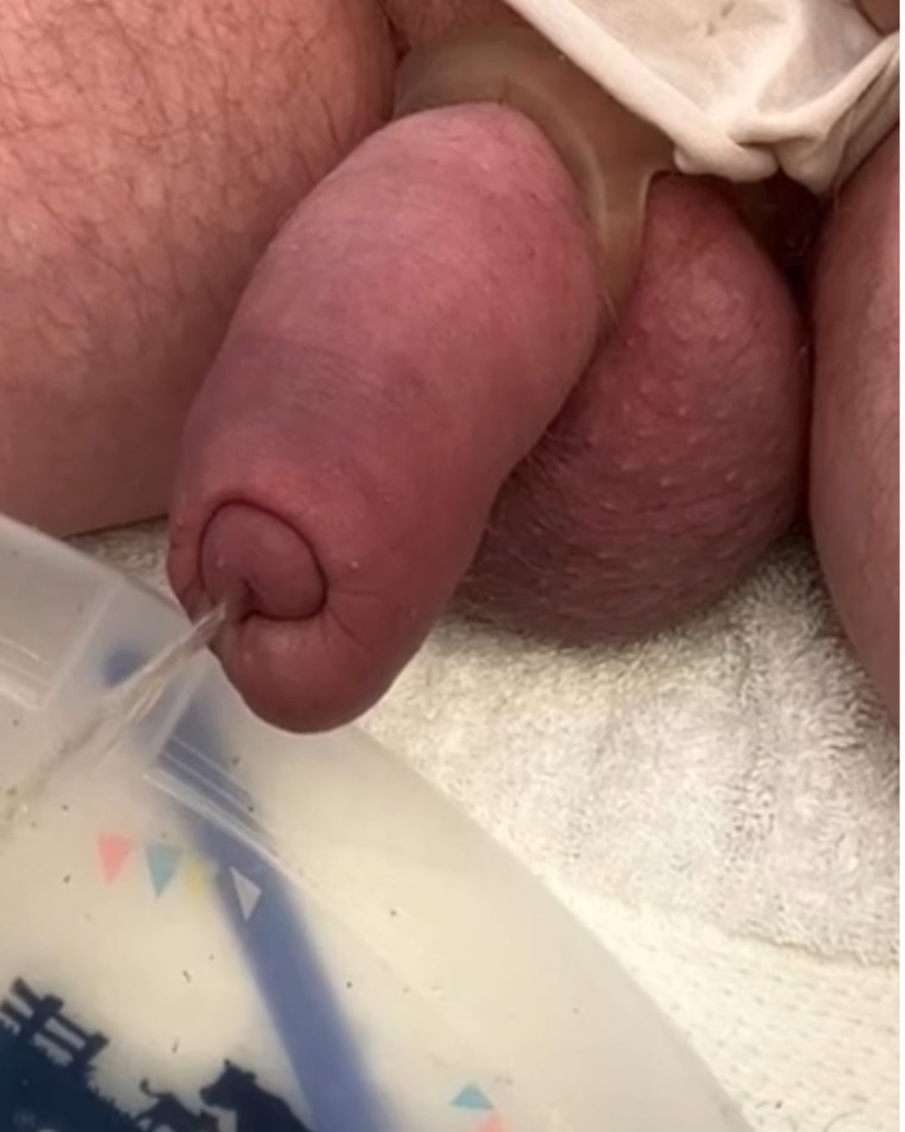 Compilation of uncut cock pics #57