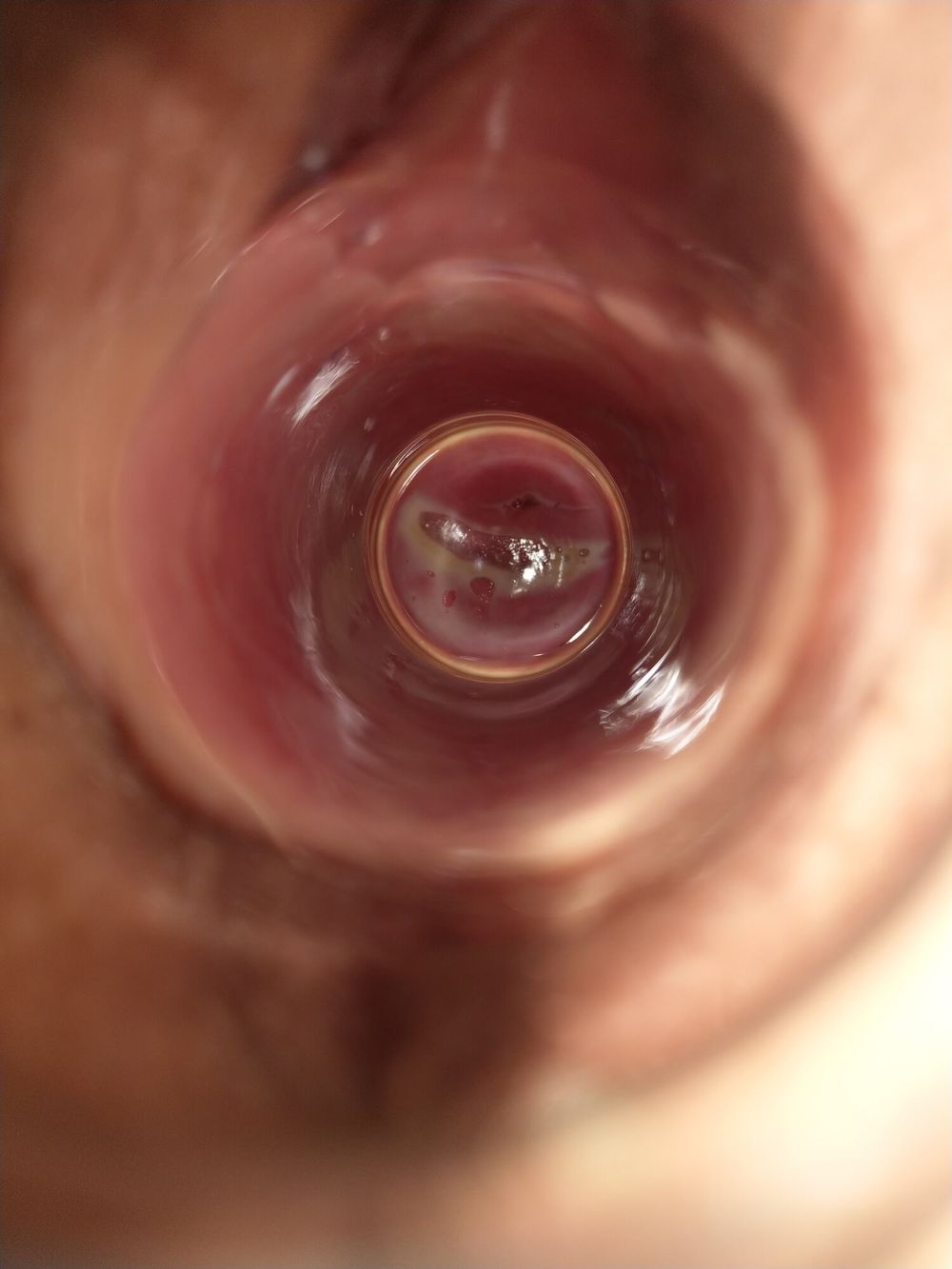 Cervix watched through glass tube in pussy