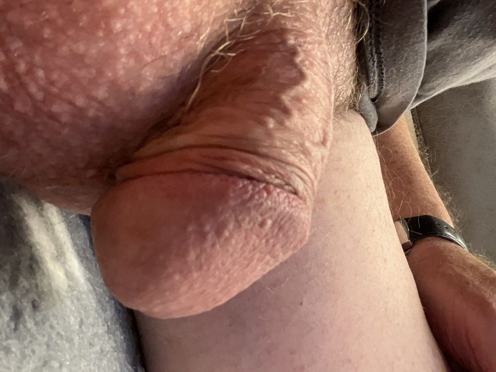 More hypo cock pics #15