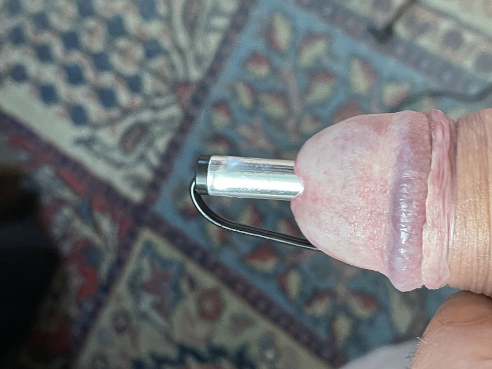 10mm Dilator in my cook