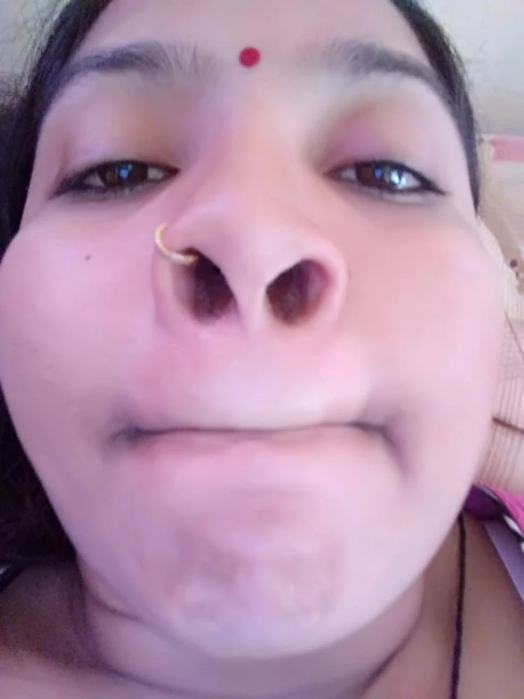 Mere open open nose (nak) holl kaise lag rahe hai