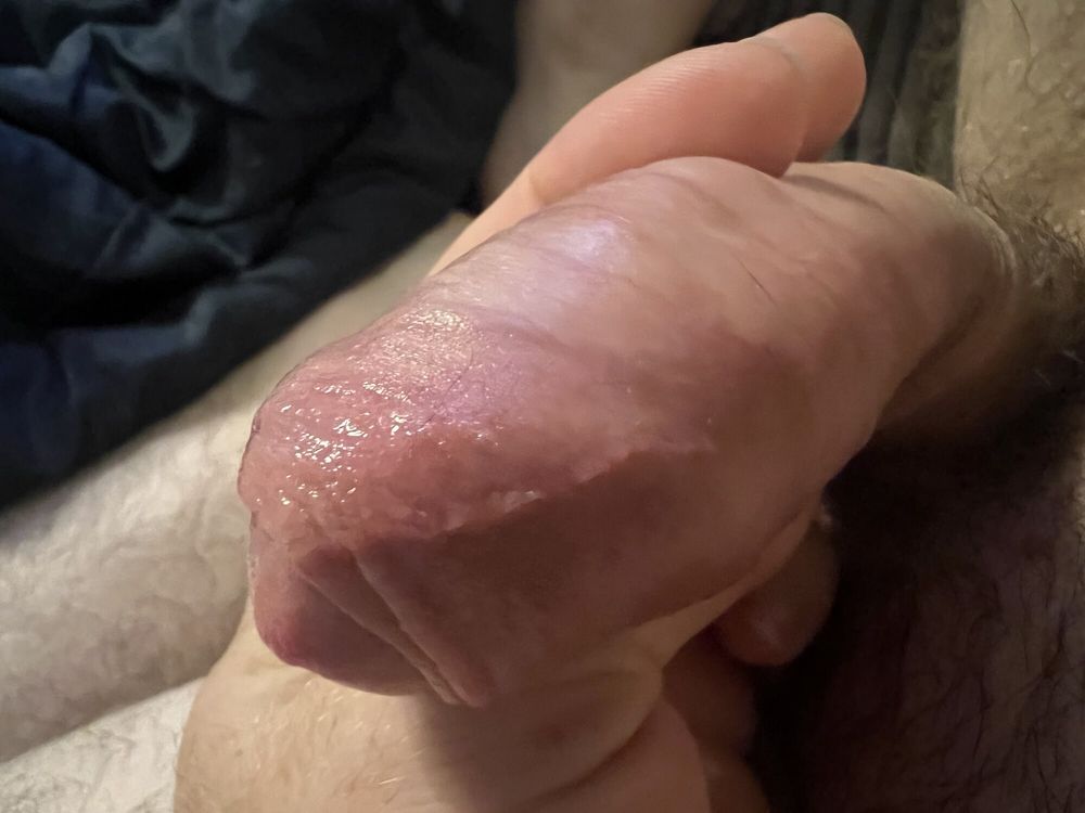 Bruised cock #2