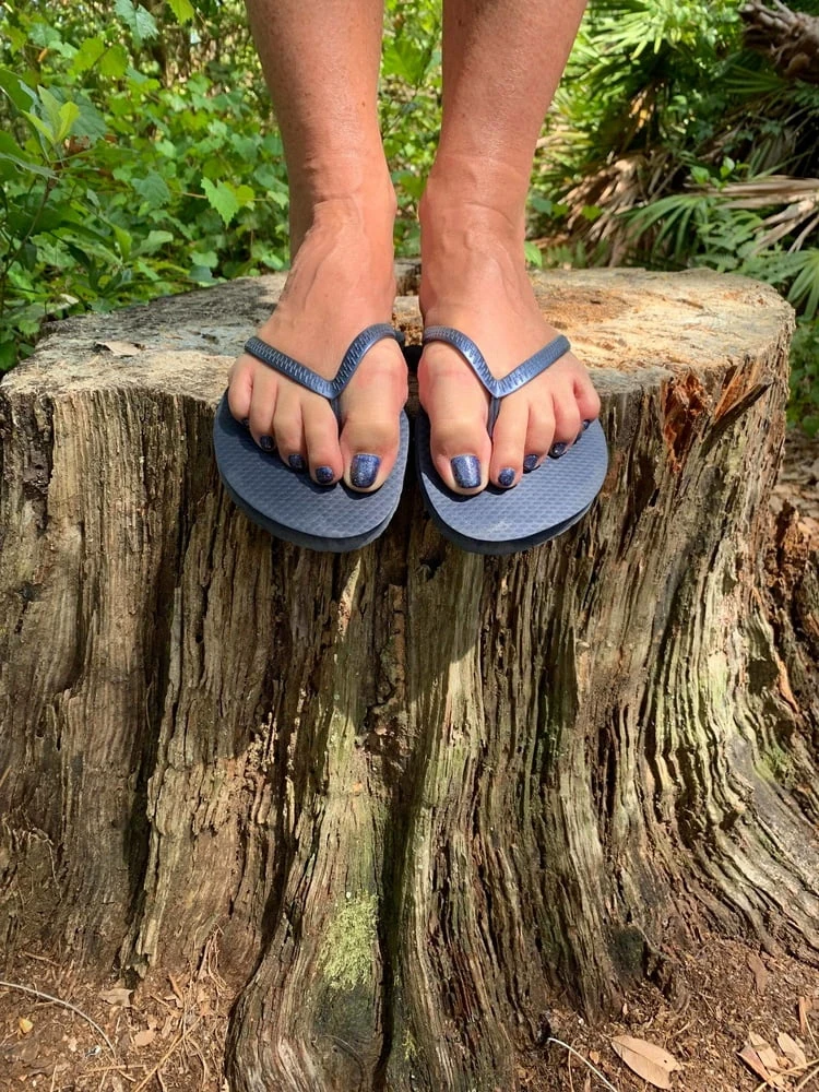 Dirty Feet and Flip Flops in the Park #24