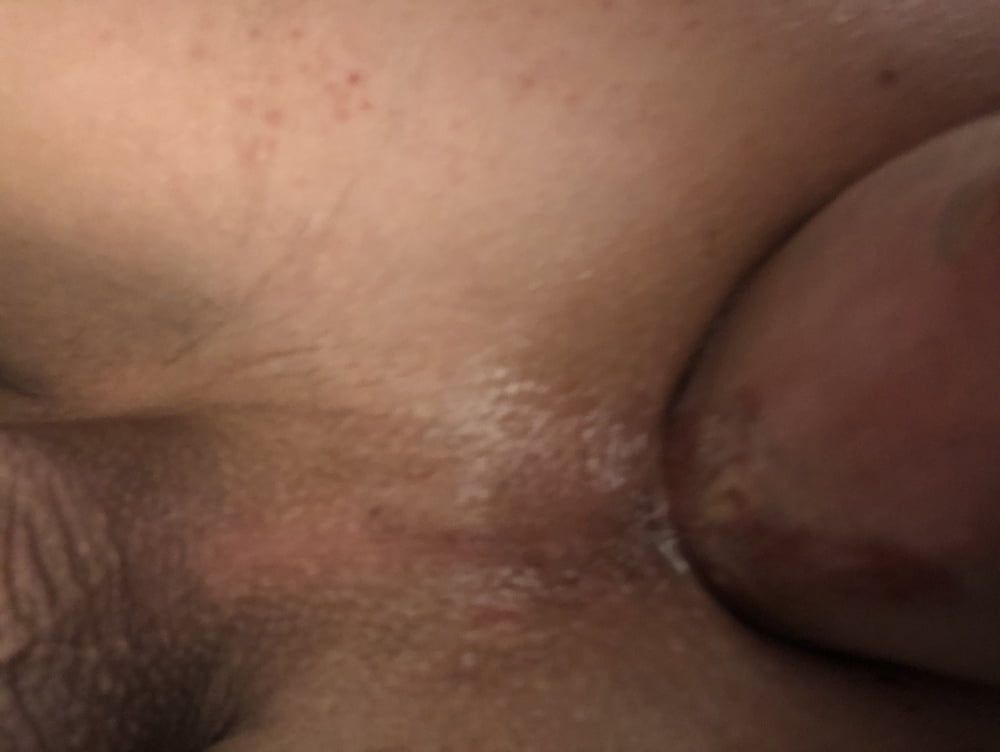 Anal masturbation  #4