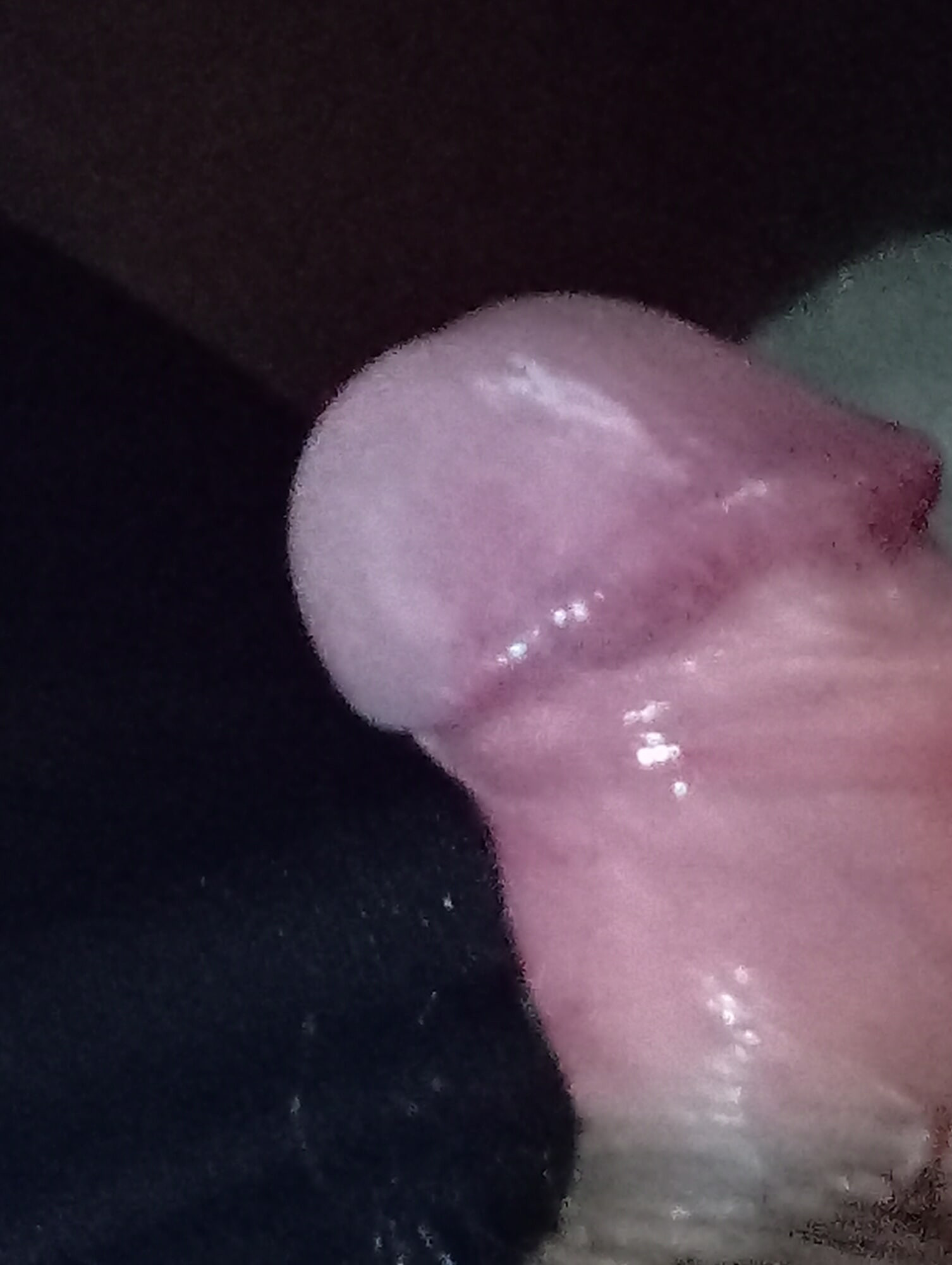 bilder av min icke-upprätt penis