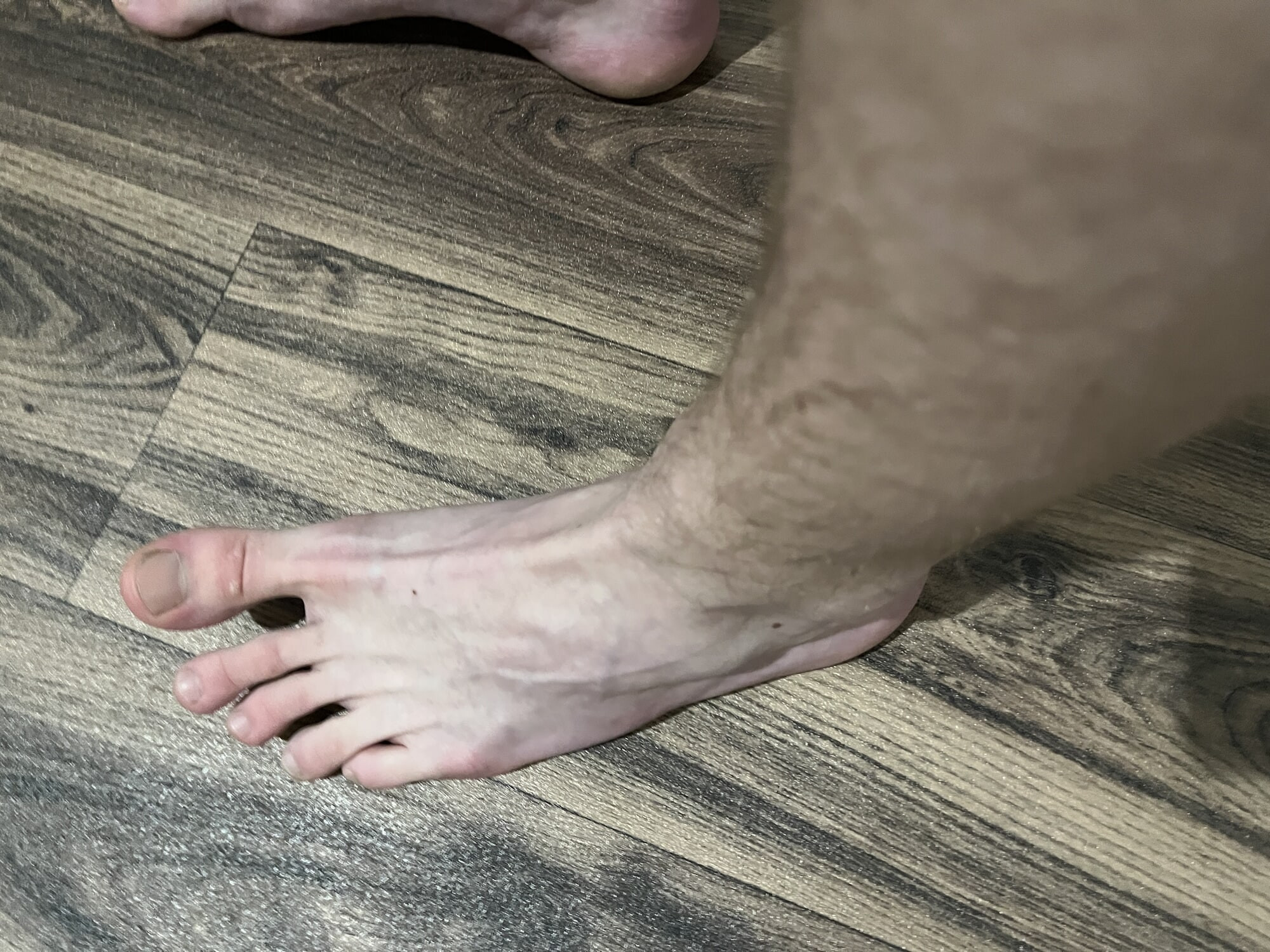 My feet #13