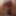 The neck of a Tropicana bottle swallowed #6