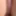 Dick