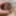 Foreskin extending with donut ring