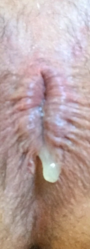 anal play  #3