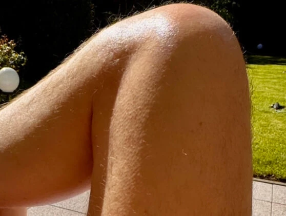 Sonne