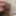 Large foreskin porn
