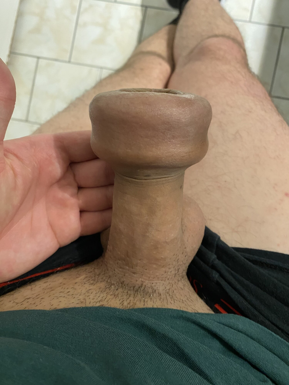 Foreskin stretching donut ring #2