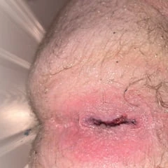 Gaping butthole 