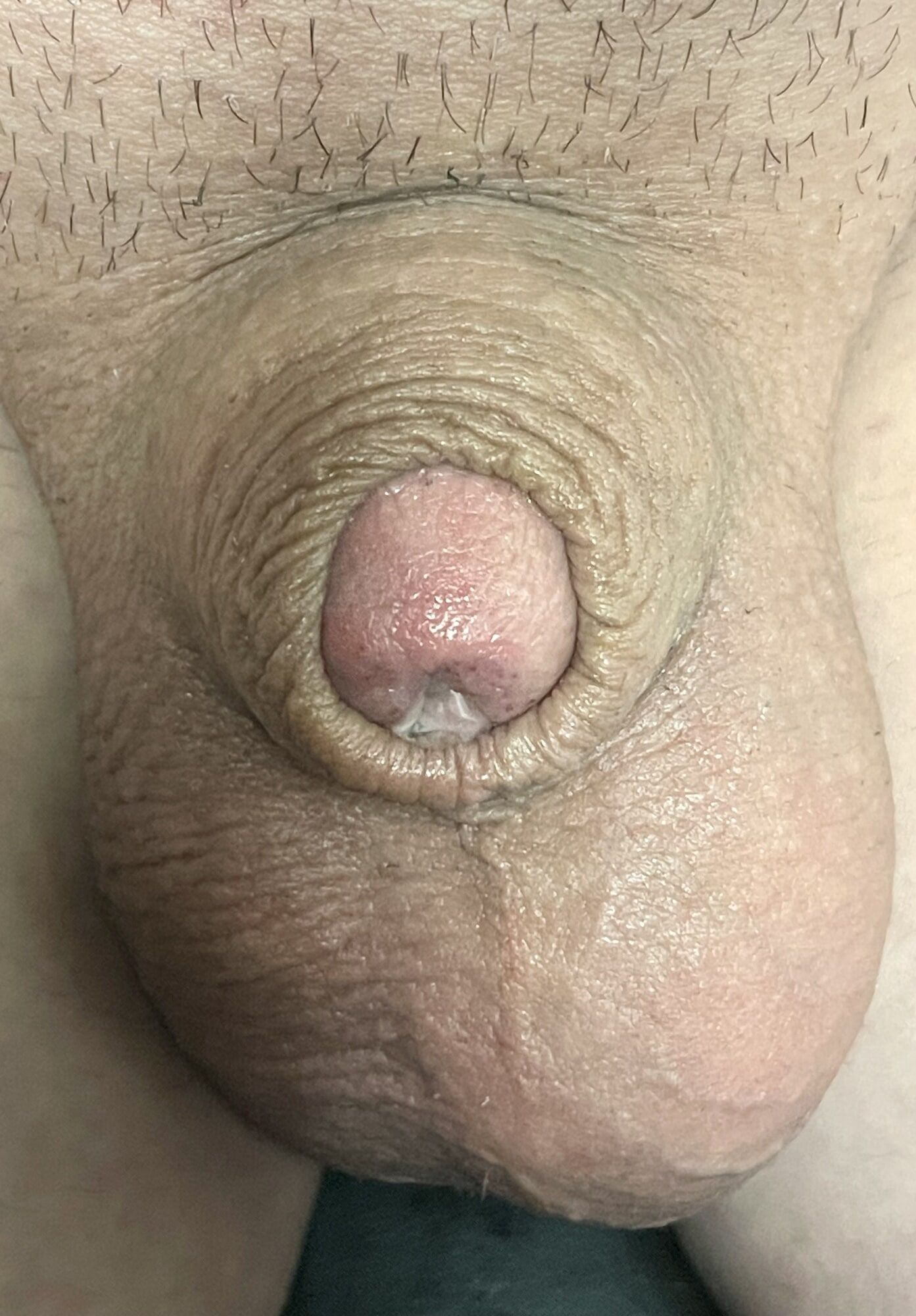 Tiny, inverted cock #9