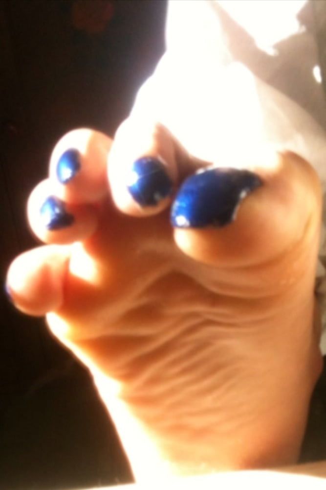 Blue toenails under sun ray #23