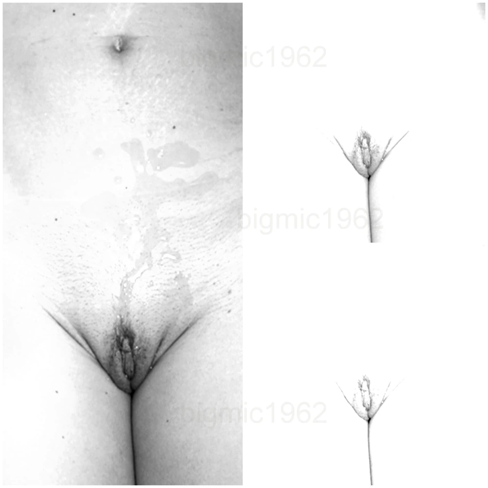 Collagen #6