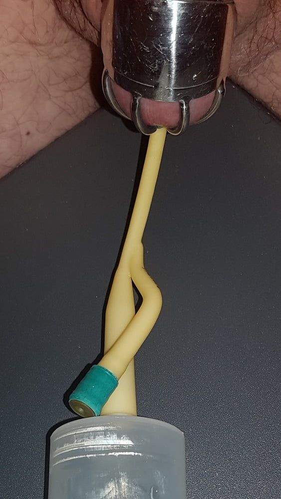 Catheter sounding with my urine 2 #39