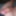 Close up foreskin and glans #9
