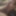 My penis before tugging 2025 #11