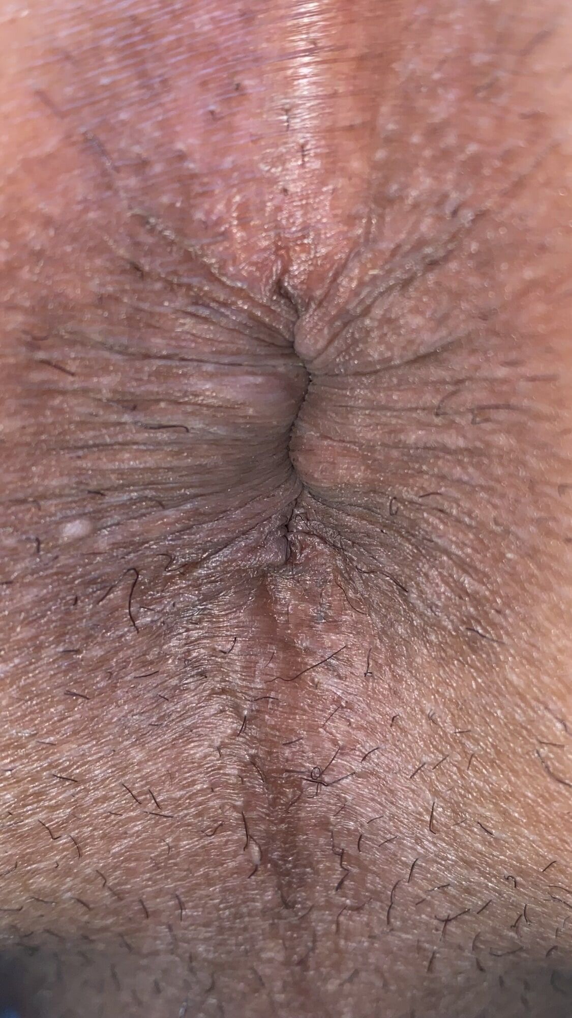 Close-up of a man's anus #17