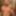 teaser