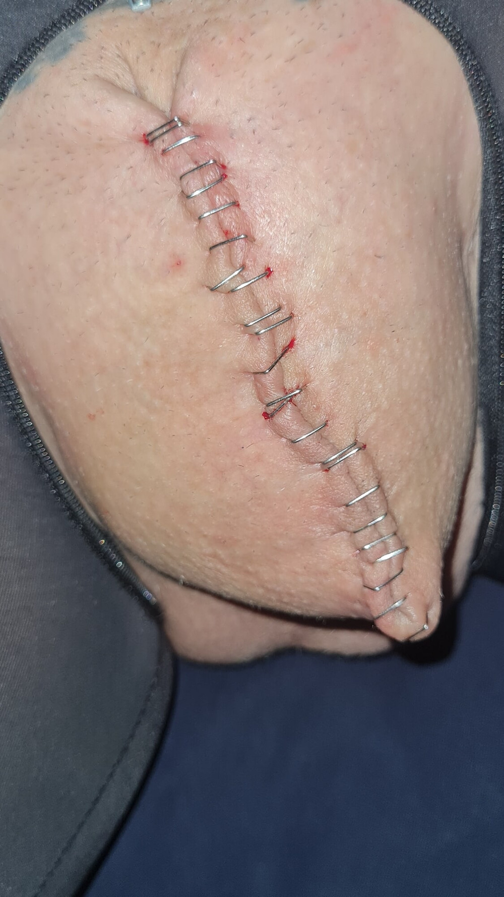 Stapled cock and balls #11