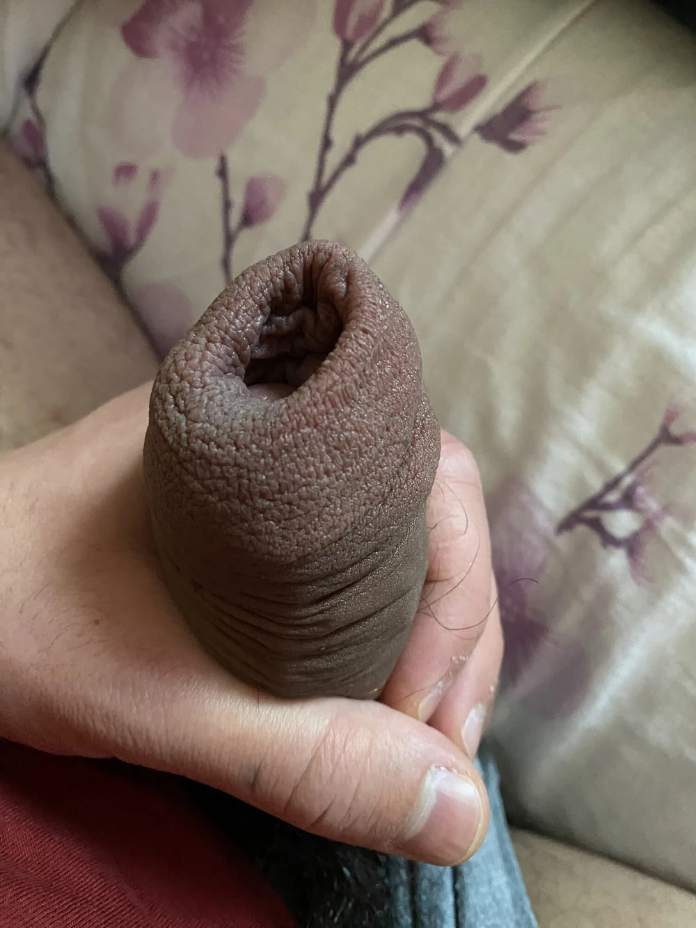 Large foreskin porn #3