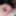 Close up foreskin and glans #5