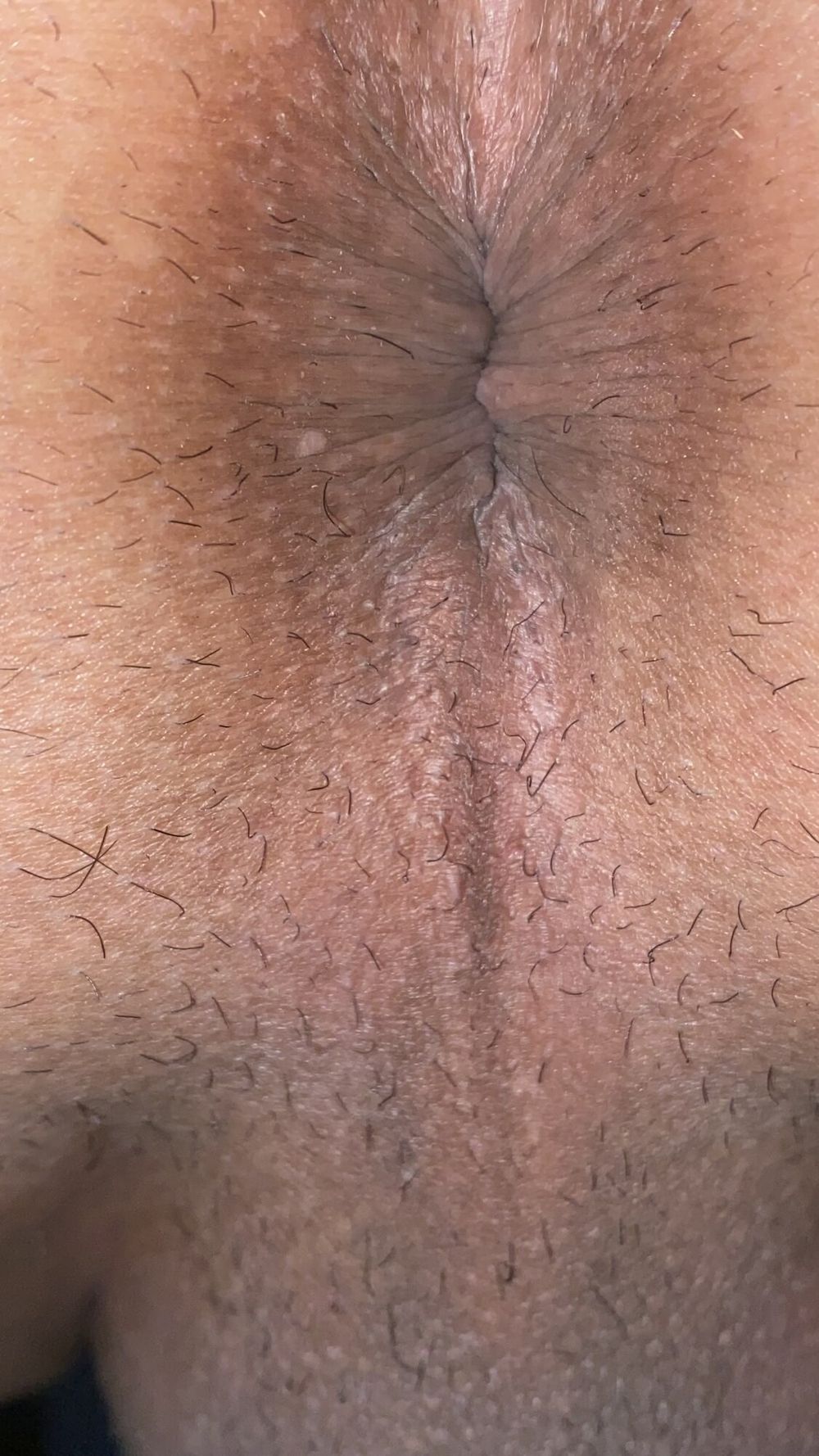 Close-up of a man&#039;s anus #22