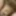 Micropenis tiny cock