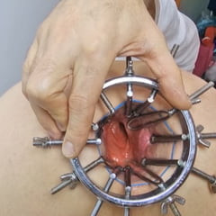 下一次试探我的肛门扩张器