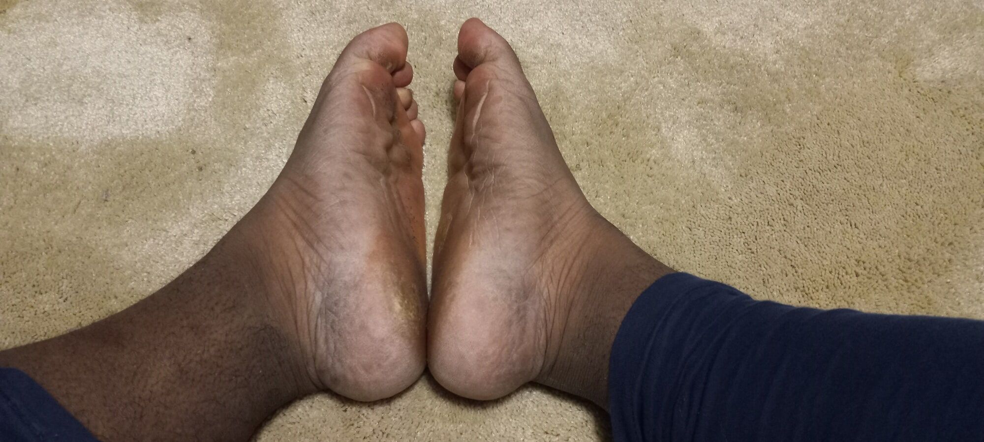 Pics of my Feet #16