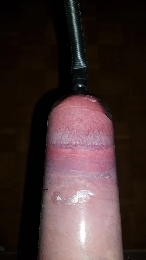 Penis pump