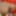 Content Teasers!