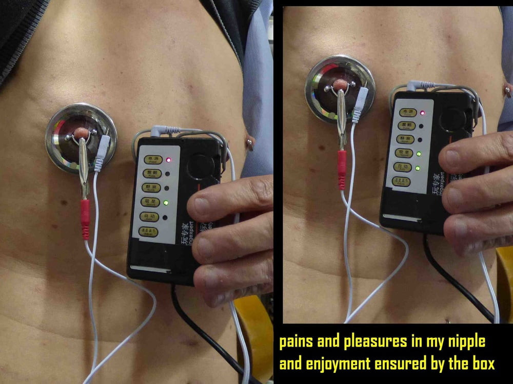 electro stimulation E-stim de paul #10