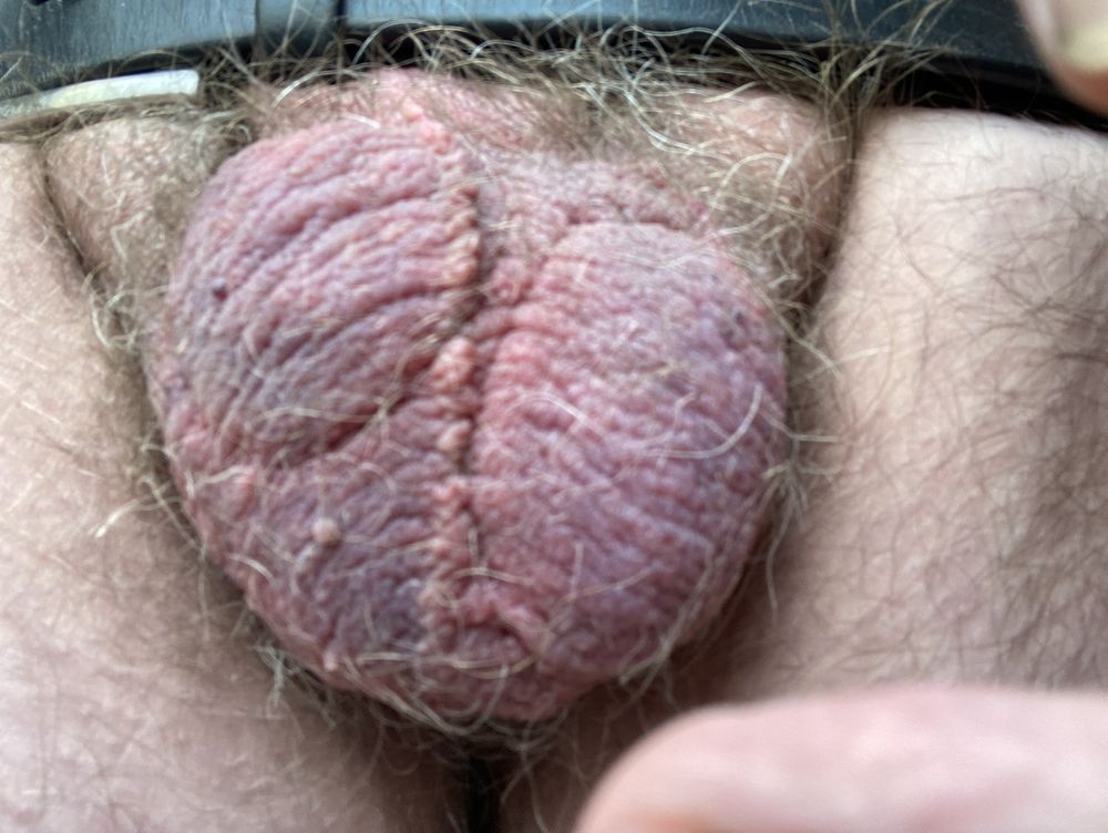 my tortured cock pics 2 #15