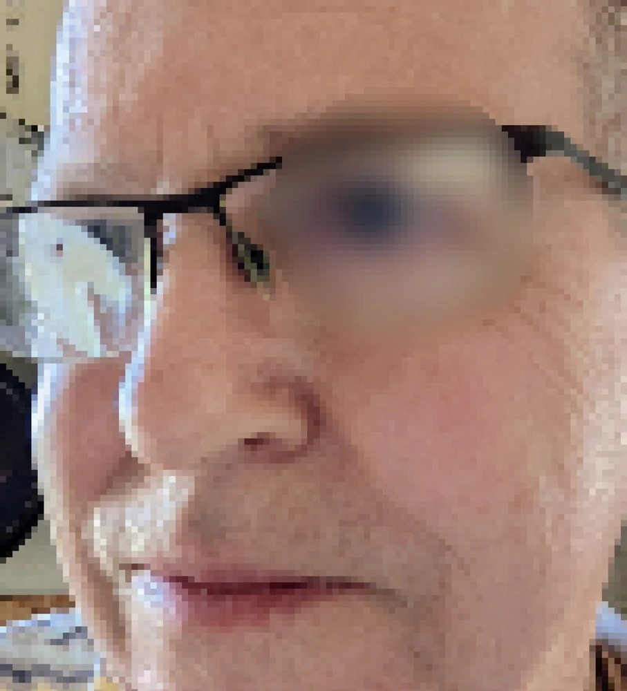 Cleaning my glasses  #4