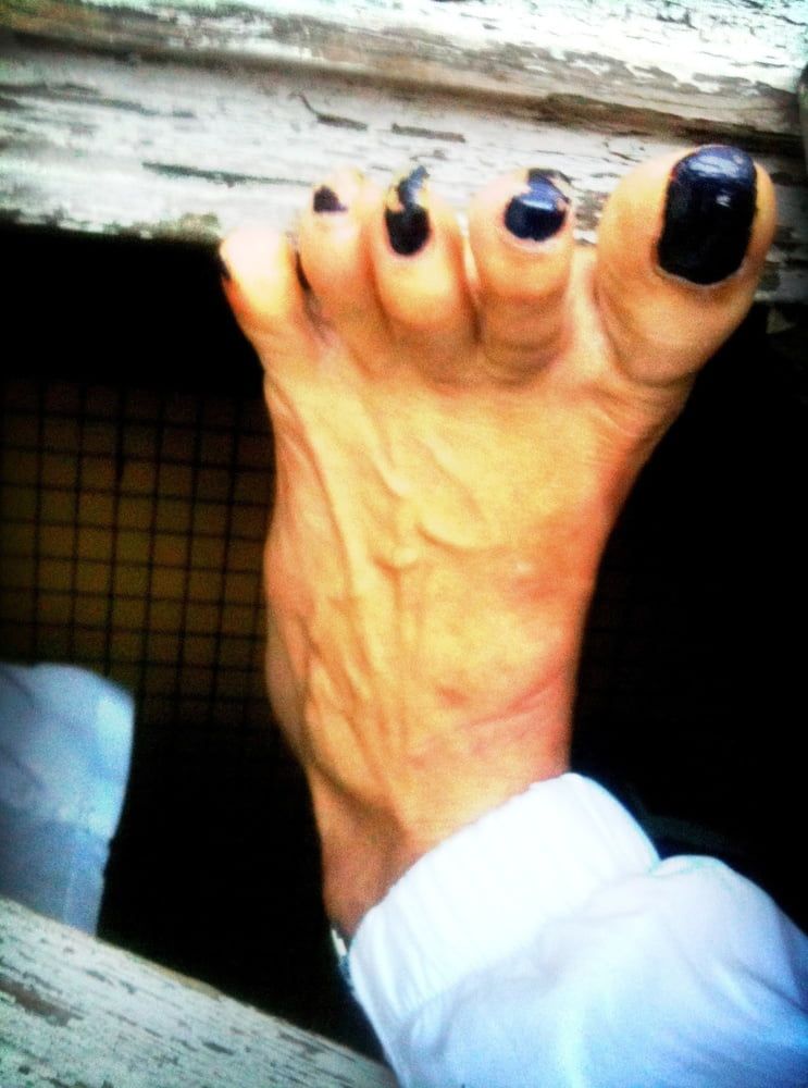 Asian ts feets, soles, toenails mix #10