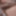 Dick
