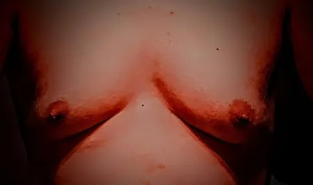 pumped sissy tits boyboobs moobs gynecomastia gyno         